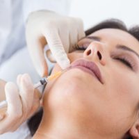 Preenchimento facial